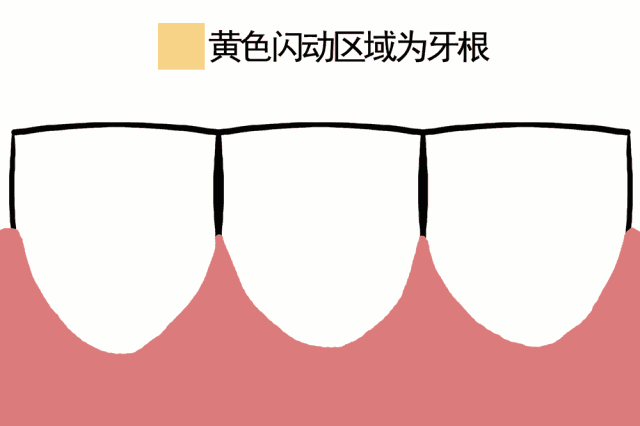 牙齿敏感.gif