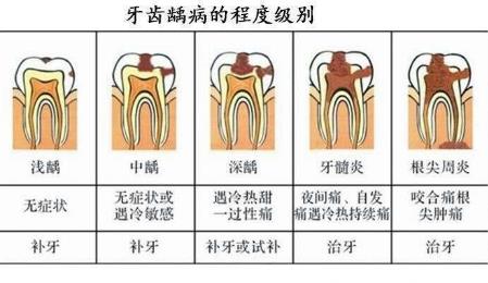 src=http___www.lovelytooth.com_uploads_allimg_191121_1-19112110362V12.jpg&refer=http___www.lovelytooth.jpg